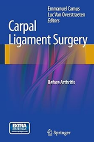 Carpal Ligament Surgery: Before Arthritis