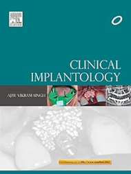 Clinical Implantology 1st Edition