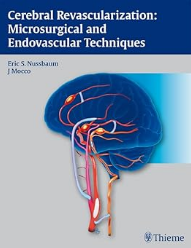 Cerebral Revascularization: Microsurgical and Endovascular Techniques