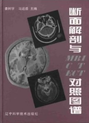 断面解剖与MRI CT ECT对照图谱