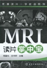 MRI读片掌中宝