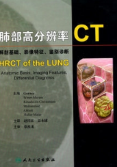 肺部高分辨率CT 解剖基础、影像特征、鉴别诊断