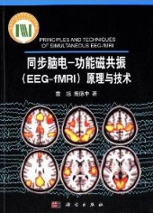 同步脑电 功能磁共振（EEG-fMRI）原理与技术