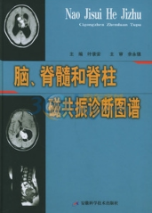 脑、脊髓和脊柱磁共振诊断图谱