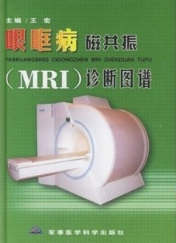 眼眶病磁共振(MRI)诊断图谱