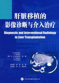肝脏移植的影像诊断与介入治疗