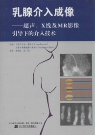 乳腺介入成像 超声、X线及MR影像引导下的介入技术