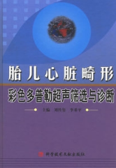 胎儿心脏畸形彩色多普勒超声筛选与诊断