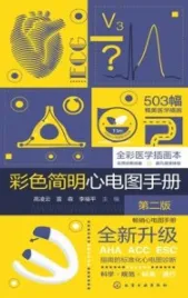 彩色简明心电图手册 第2版
