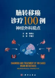 脑转移癌诊疗100例 神经外科观点