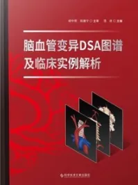 脑血管变异DSA图谱及临床实例解析
