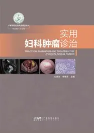 实用妇科肿瘤诊治