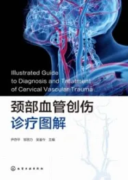 颈部血管创伤诊疗图解