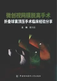 微创视网膜脱离手术