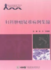 妇科肿瘤疑难病例集锦