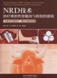 NRD技术治疗难治性骨髓炎与软组织感染 “牛鼻子引流技术”理论与临床实践