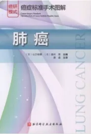 癌症标准手术图解 肺癌