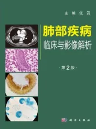 肺部疾病临床与影像解析（第2版）