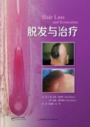 脱发与治疗
