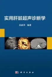 实用肝脏超声诊断学