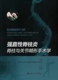 强直性脊柱炎 脊柱与关节畸形手术学