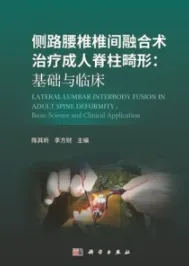 侧路腰椎椎间融合术治疗成人脊柱畸形 基础与临床