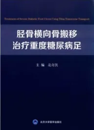 胫骨横向骨搬移治疗重度糖尿病足