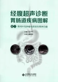 经腹超声诊断胃肠道疾病图解 卷2 胃间叶性肿瘤与原发性胃淋巴瘤