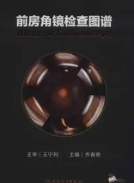 前房角镜检查图谱