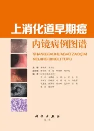 上消化道早期癌内镜病例图谱