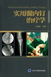 实用髓内钉治疗学