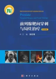 前列腺靶向穿刺与局灶治疗