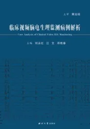 临床视频脑电生理监测病例解析