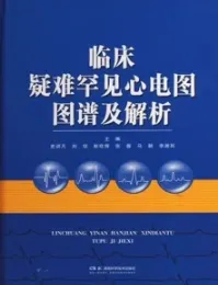 临床疑难罕见心电图图谱及解析