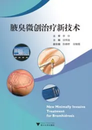 腋臭微创治疗新技术