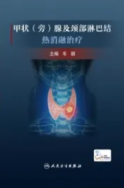 甲状(旁)腺及颈部淋巴结热消融治疗