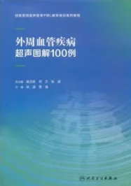 外周血管疾病超声图解100例