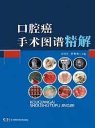 口腔癌手术图谱精解
