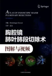 胸腔镜肺叶肺段切除术图解与视频