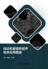 自动乳腺容积超声临床应用图谱