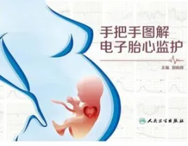 手把手图解电子胎心监护