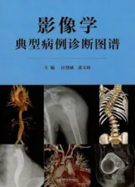 影像学典型病例诊断图谱