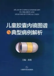 儿童胶囊内镜图谱与典型病例解析