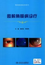图解角膜病诊疗