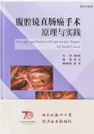 腹腔镜直肠癌手术原理与实践
