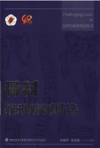 骨科疑难病例精选