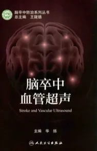 脑卒中血管超声