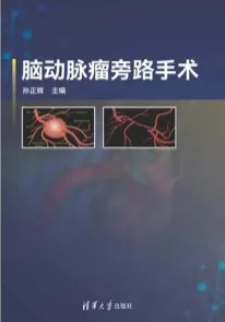 脑动脉瘤旁路手术