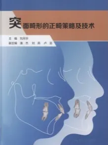突面畸形的正畸策略及技术