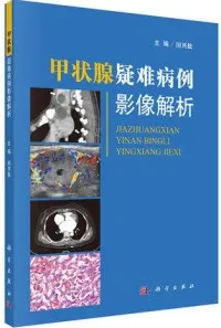 甲状腺疑难病例影像解析